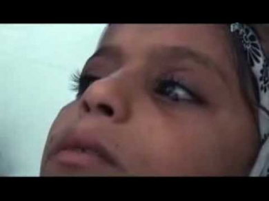 У девочки из Йемена вместо слез из глаз текут камни