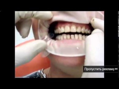 Белые зубы сода