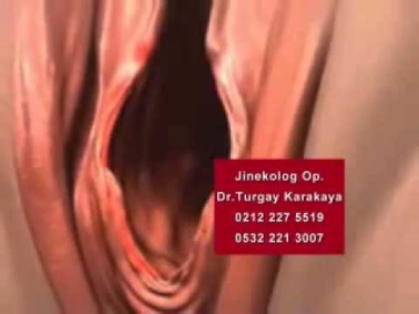 Kızlık Zarı Dikimi - Dr. Turgay Karakaya