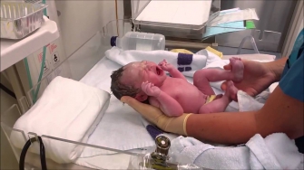 Day1 Newborn Baby LIVE C Section Delivery CUTE & TINY Crying Very LOUD & Angry!