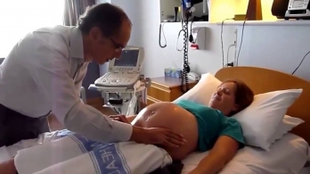 Watch the incredible moment a doctor turns a breech baby around in a pregnant woman's stomach